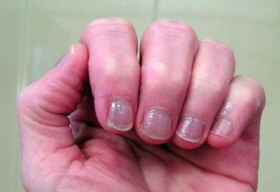 fingers1 fingers1